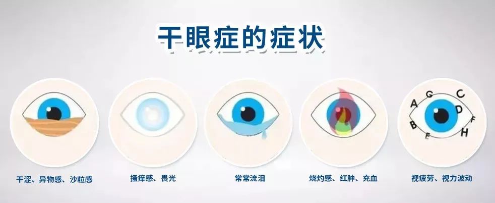 春节宅家中眼睛红干涩痛痒等不适千万别轻视