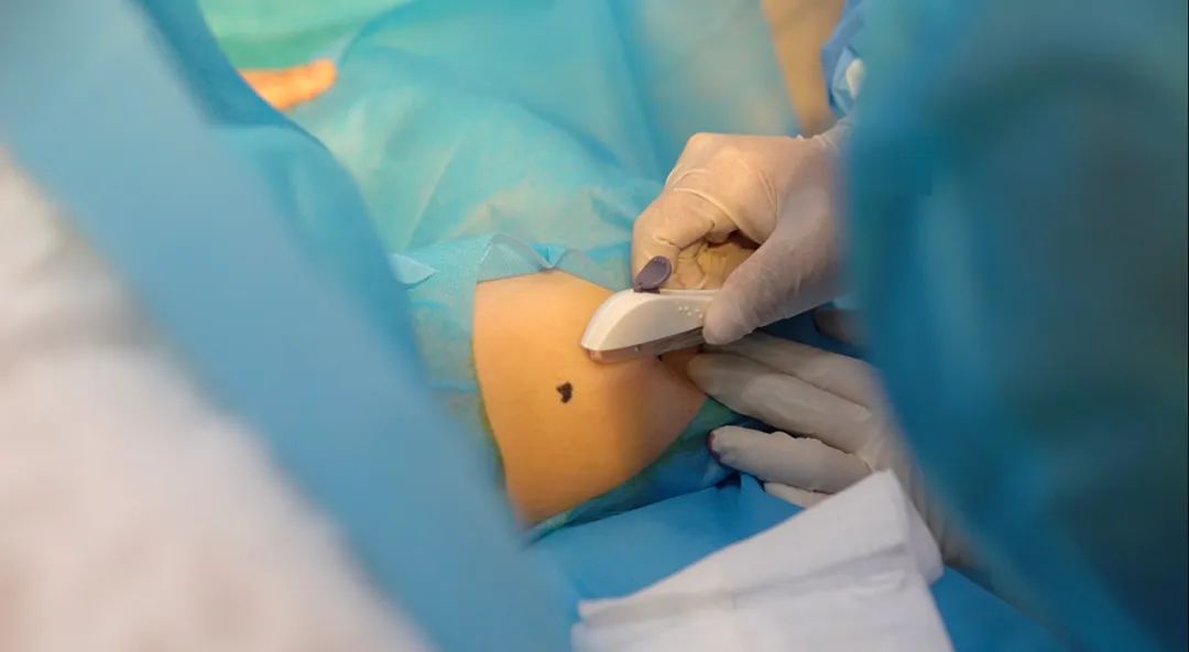 大家都是成年人这么好的避孕方法你都不知道